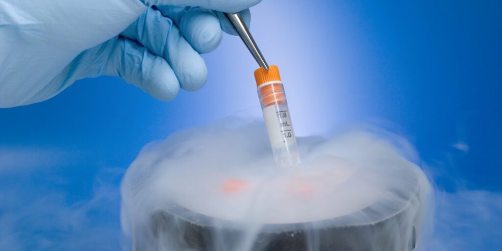 Cryopreservation & Fertility Freezing Unit